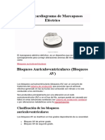 Electrocardiograma de Marcapasos Eléctrico