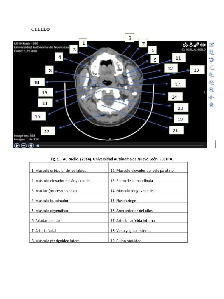 Anatomia Multiplanar-Kevin Olmedo Vanegas Unidad 2 Tarea 4. | PDF ...