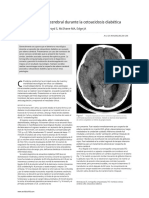 Trombosis Cerebral en Cetoacidosis Diabetica - En.es