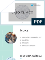 Caso Clinico Paciente Implantes