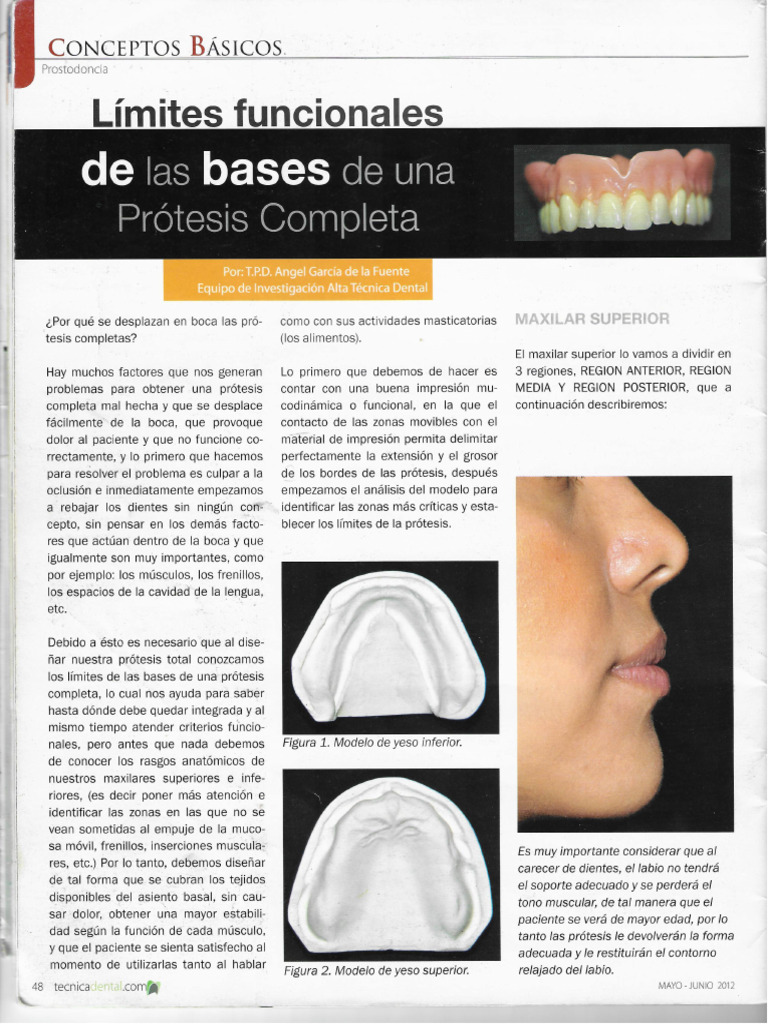 2-1 Tema Limites Funcionales de Las Bases de Una Protesis | PDF