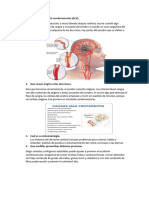 Que Es El Accidente Cerebrovascular