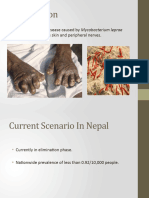 Leprosy in Nepal - 2