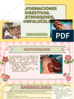 Cordova Dayan Malformaciones Digestivas. Gastrosquisis, Onfalocele