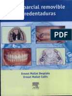 2 Protesis Parcial y Sobredentadura Ernest Mallat y Thomas Keogh 2 PDF Free