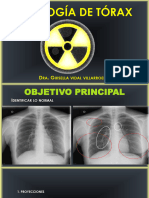 RX de Torax