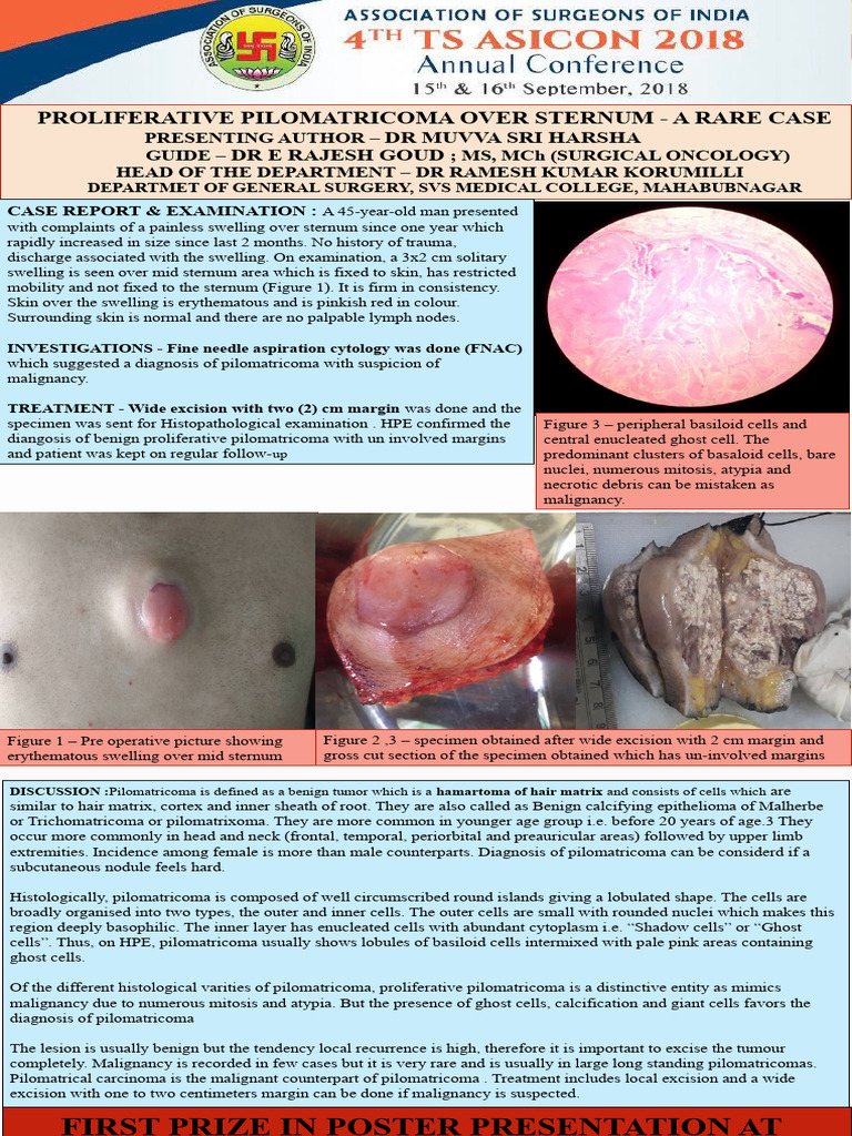 Pilo Matri Coma Poster PDF Medical Specialties Neoplasms