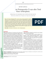 Orthopaedic Surgery - 2014 - Kumar - How To Interpret Postoperative X Rays After Total Knee Arthroplasty