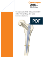 TRIGEN INTERTAN Gold OP Technik