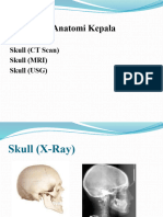 NEURORADIOLOGI (Revisi)