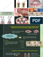 Principios oclusales posteriores al implante