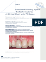 Gingival Recession After Endo Surg in The Esthetic Zone Von Arx 2009