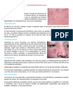 Carcinoma Derma