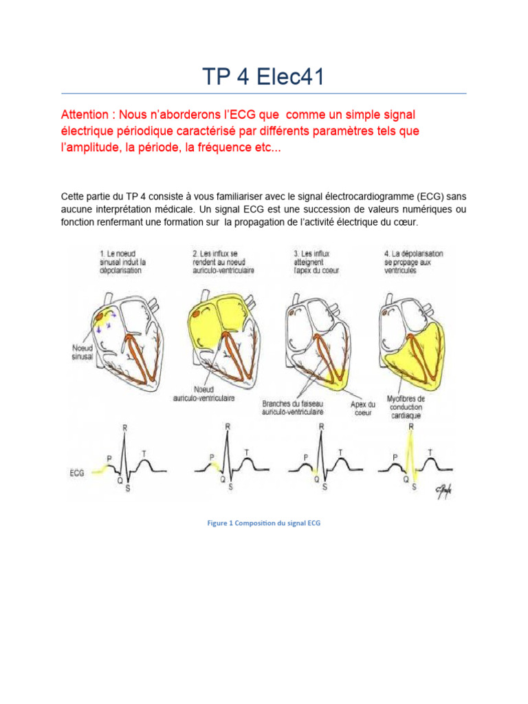 Traitement du Signal ECG en TP 4 | PDF | Électrocardiographie | Physiologie