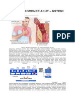 Sindrom Koroner Akut