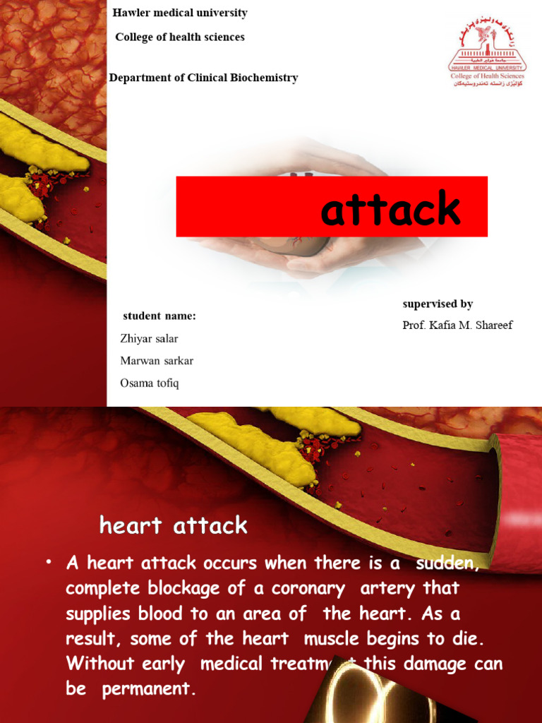 Heart Attack Pdf Myocardial Infarction Heart