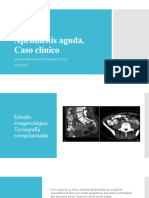 Apendicitis Aguda