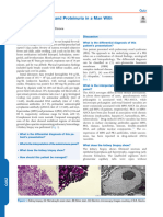 Acute Kidney Injury and Proteinuria in A Man With Hemoptysis