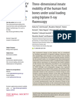 Mobilidade Natural Tridimensional Do Pé Sobre Aplicacao de Carga Axial Fluoroscopia Usando Raio X Bidimensional