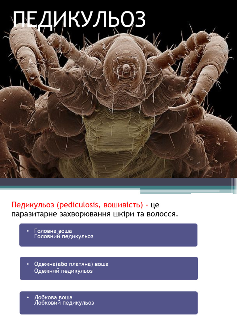 педикульоз | PDF