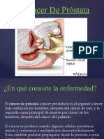 Cancer de Prostata Generalidad