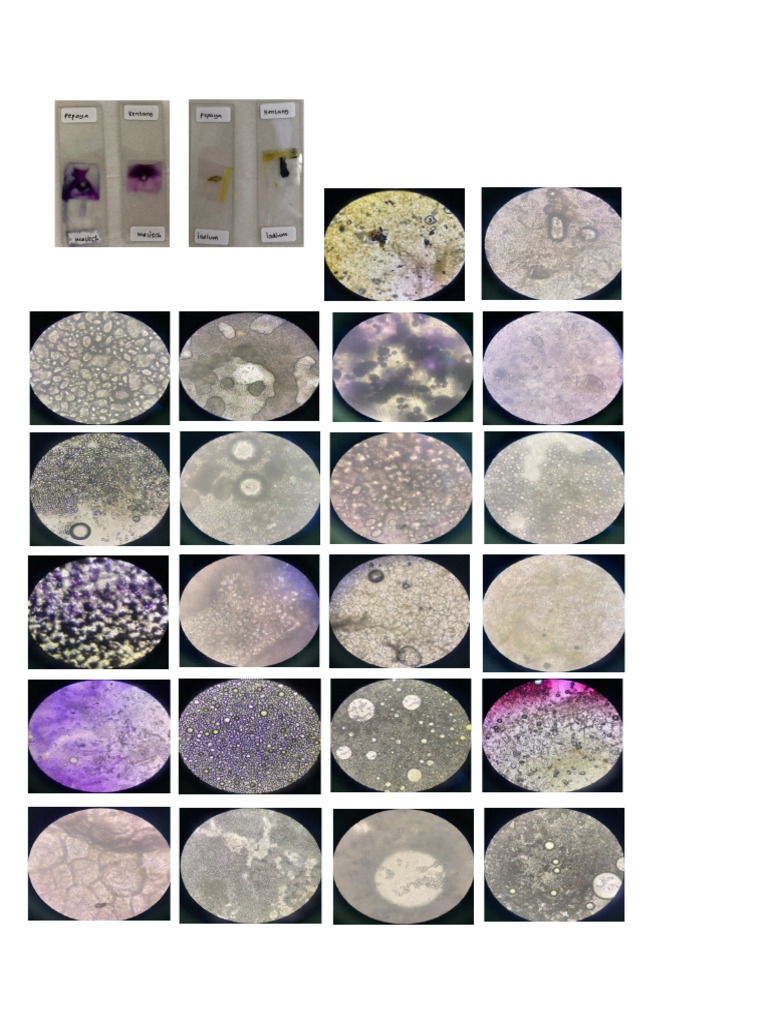 Gambar Mikroskop Amylum | PDF