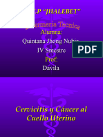 Cervicitis, Cancer Al Cuello Uterino