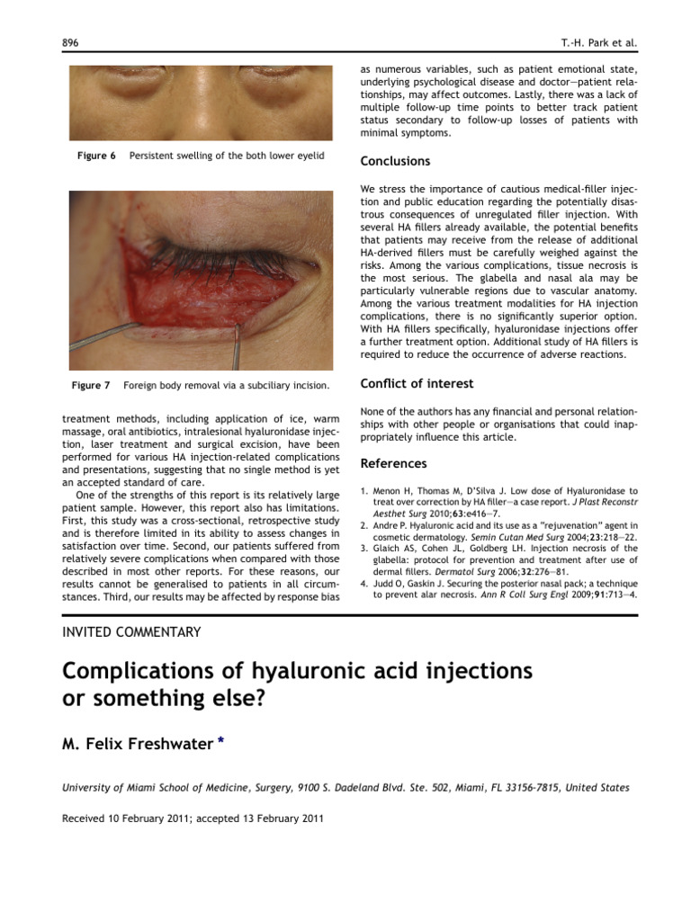 ComplicationsOfHyaluronicAcidInjectionsOrSom 2 PDF Surgery