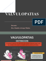 Valvulopatia