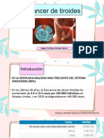 Cáncer de Tiroides Nuevo