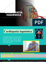 Cardiopatia Isquemica CORREGIDO