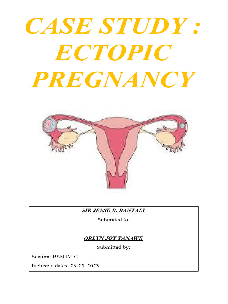 case study about ectopic pregnancy scribd