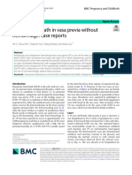 Intrauterine Death in Vasa Previa Without Hemorrhage: Case Reports