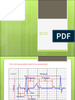 ? Ecg ?