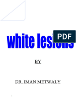 3-White Lesions Lichen Planus