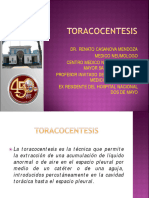 TORACENTESIS