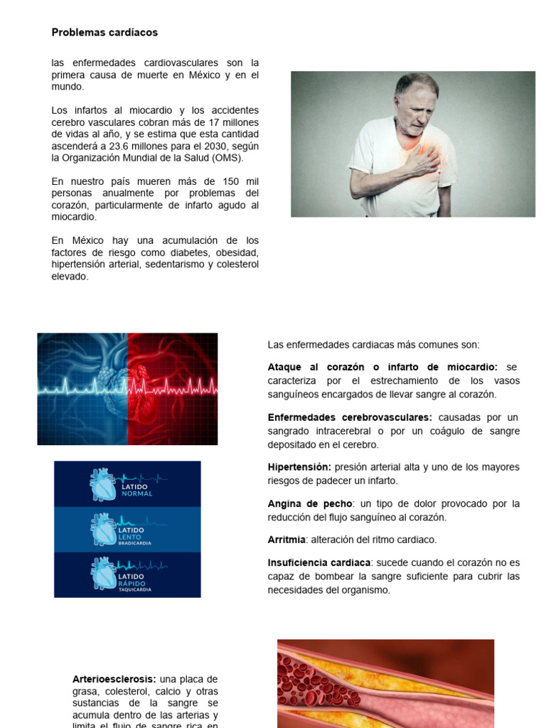 Enfermedades Cardiovasculares y Tratamientos | PDF | Infarto de ...