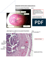 Repaso Imágenes Histología Ginecológica