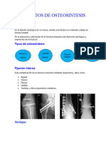 Aparatos de Osteosintesis