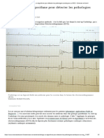 Cardiologs - Un Algorithme Pour Détecter Les Pathologies Cardiaques Sur ECG - Sciences Et Avenir