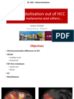 Reta Radioembolizacion en Metastasis Colangio Neuroendocrino