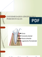 Unidad 4 Enfermedades Gingivales y Periodontales