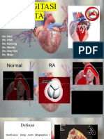 Regurgitasi Aorta