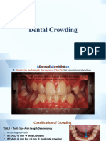 Dental Crowding Abdullah