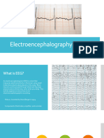 Electroencephalography