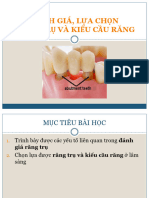 Đánh Giá Chọn Lựa Răng Trụ Và Kiểu Cầu Răng