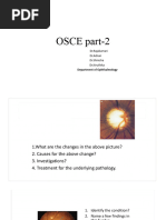Understanding Lens Transposition Methods | PDF | Lenses | Optics