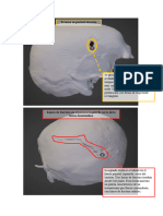Casos Clinicos - Lesiones Craneales