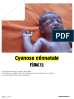 Cyanose Néonatale