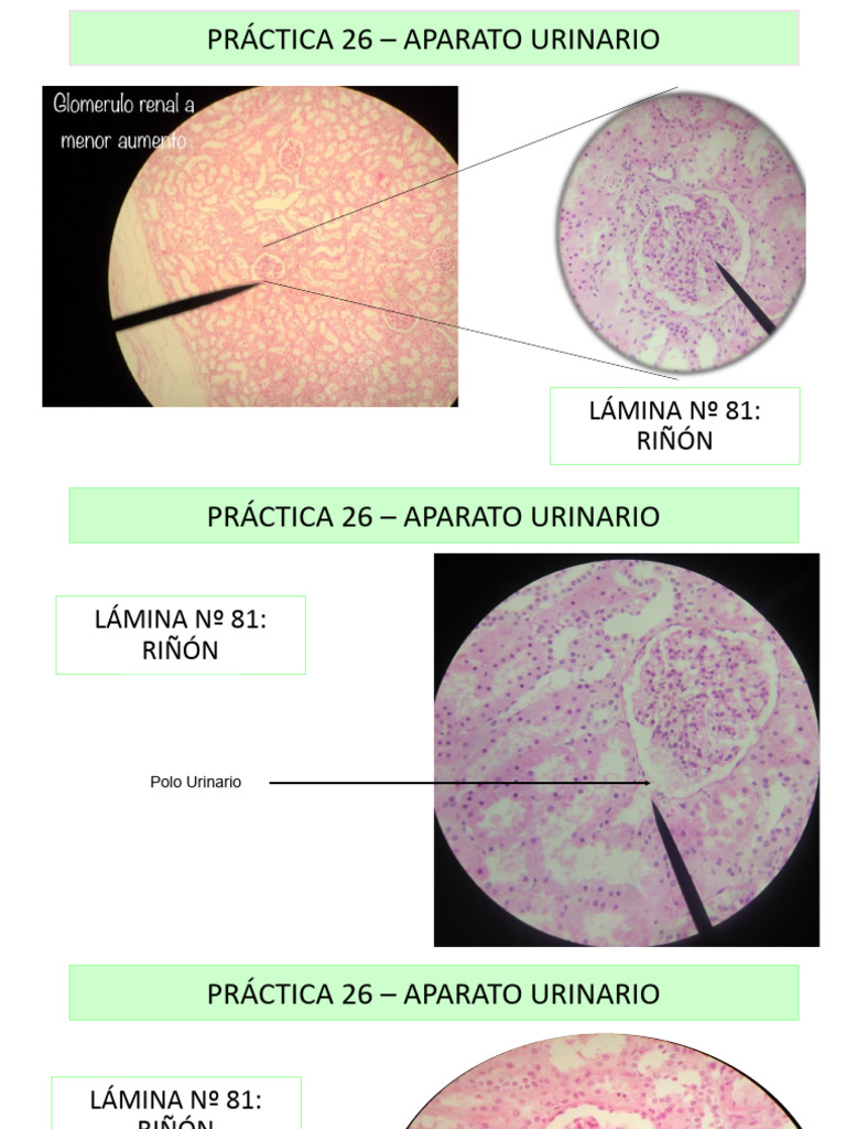 Practica de Histologia Riñon | PDF